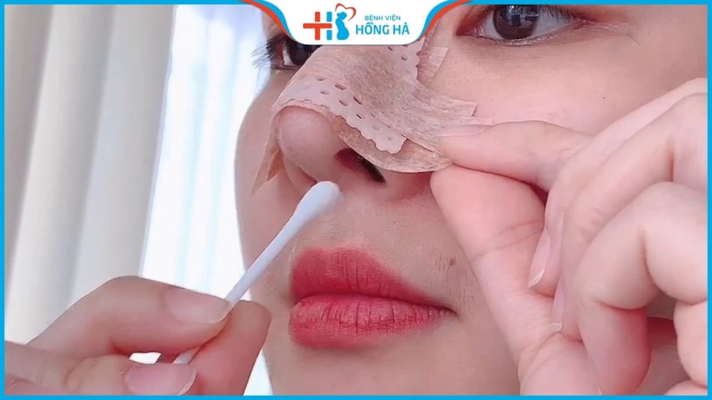 Cắt chỉ nâng mũi có đau không? Thời điểm vàng để cắt chỉ nâng mũi