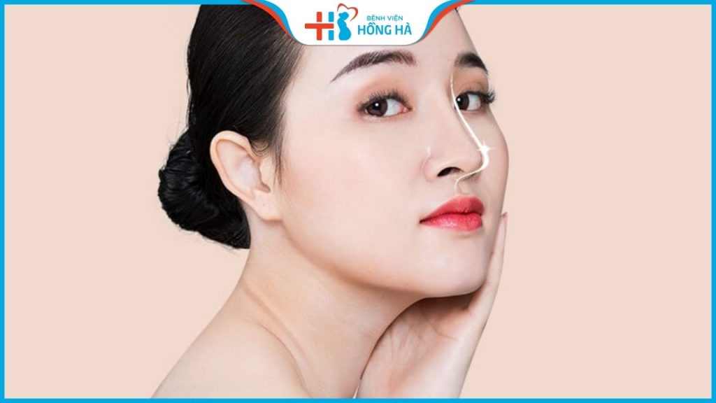 Có nên nâng mũi bọc sụn không? Địa chỉ nâng mũi bọc sụn uy tín nhất