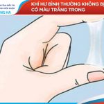 Nguyên nhân và cách xử lý khí hư bất thường