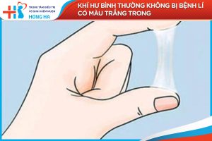 Nguyên nhân và cách xử lý khí hư bất thường