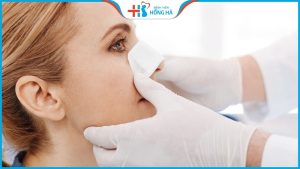 Nâng mũi bao lâu hết sưng? 3 lưu ý để nâng mũi nhanh lành và đẹp