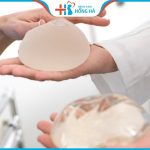 Hỏi đáp chuyên gia: Nâng ngực loại nào tốt nhất? 5 loại phổ biến