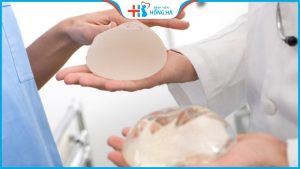 Hỏi đáp chuyên gia: Nâng ngực loại nào tốt nhất? 5 loại phổ biến