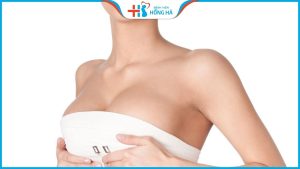 Nâng ngực phải kiêng quan hệ bao lâu – Giải đáp chuyên gia