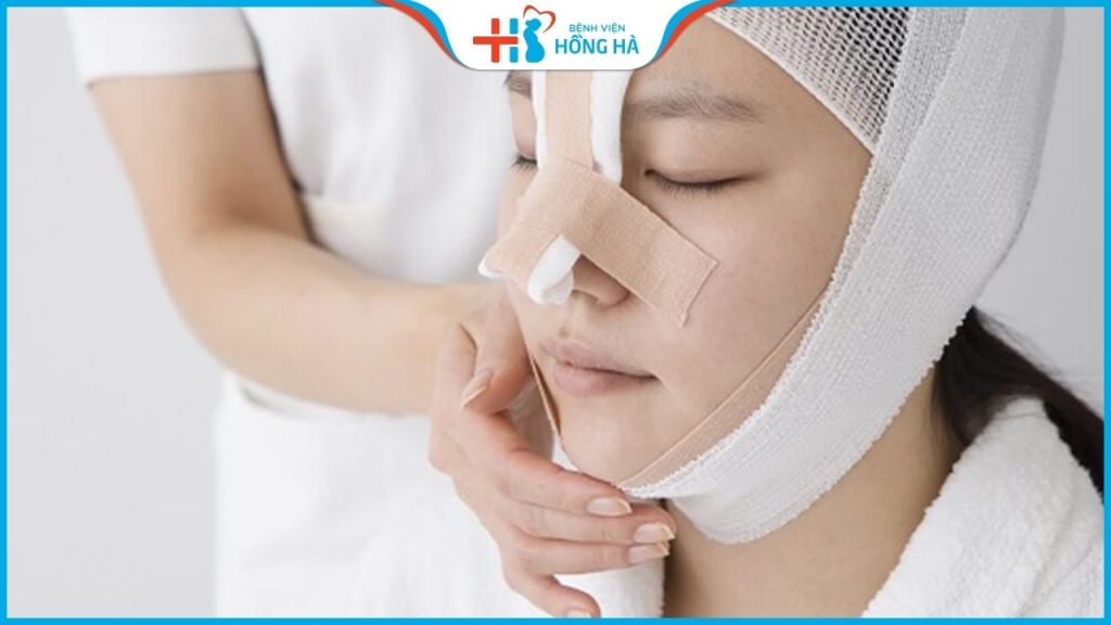 Thời gian nâng mũi bao lâu để có chiếc mũi đẹp tự nhiên?