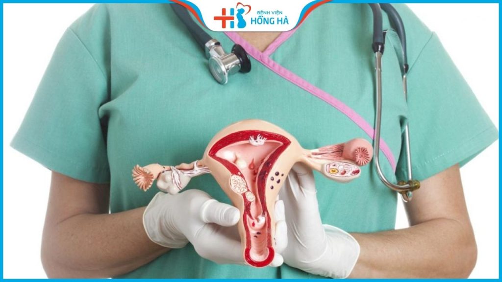 TOP các loại thuốc chữa u nang buồng trứng hiệu quả