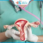 TOP các loại thuốc chữa u nang buồng trứng hiệu quả