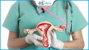 TOP các loại thuốc chữa u nang buồng trứng hiệu quả