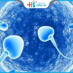 Tinh trùng nóng là gì? 9 cách cải thiện hiện tượng tinh trùng nóng hiệu quả