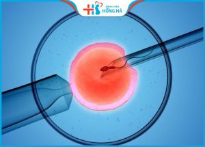 IVF Thụ tinh ống nghiệm: Tỷ lệ thành công và lời khuyên cho cặp vợ chồng