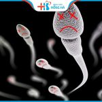 Tác động của tình trạng tinh trùng dị dạng đến khả năng sinh sản nam