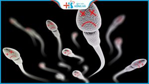 Tác động của tình trạng tinh trùng dị dạng đến khả năng sinh sản nam