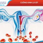 80% phụ nữ mắc bệnh cường kinh: Cách phòng tránh và điều trị hiệu quả