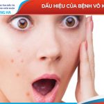 Vô kinh ở phụ nữ: Nguyên nhân và cách điều trị hiệu quả nhất