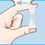 13 dấu hiệu vô sinh ở nam giới và nữ giới cần nhận biết sớm