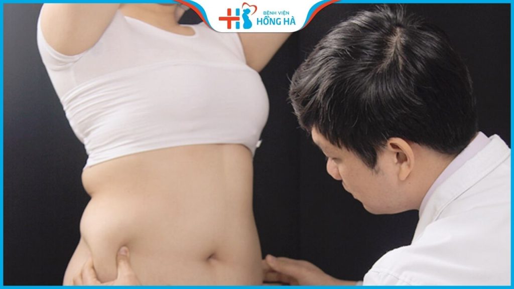 Giá hút mỡ bụng? Ưu điểm khi hút mỡ bụng tại Bệnh viện Hồng Hà
