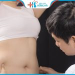 Giá hút mỡ bụng? Ưu điểm khi hút mỡ bụng tại Bệnh viện Hồng Hà