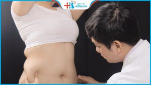Giá hút mỡ bụng? Ưu điểm khi hút mỡ bụng tại Bệnh viện Hồng Hà