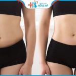 Hút mỡ uy tín tại Hà Nội: Review địa chỉ tốt nhất từ sao Việt
