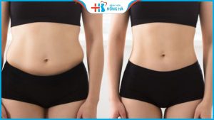 Hút mỡ uy tín tại Hà Nội: Review địa chỉ tốt nhất từ sao Việt