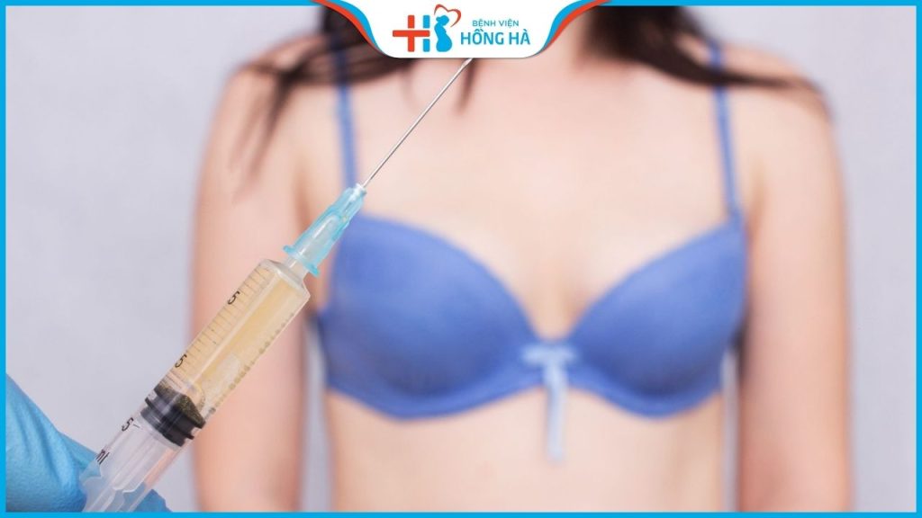 Nâng ngực bằng mỡ tự thân: Có tốt không, đau không, giá bao nhiêu?