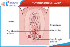 Nang tuyến Bartholin: Triệu chứng, nguyên nhân và điều trị hiệu quả