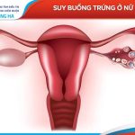 Suy buồng trứng: Nguyên nhân và cách điều trị bệnh hiệu quả nhất