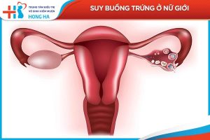 Suy buồng trứng: Nguyên nhân và cách điều trị bệnh hiệu quả nhất