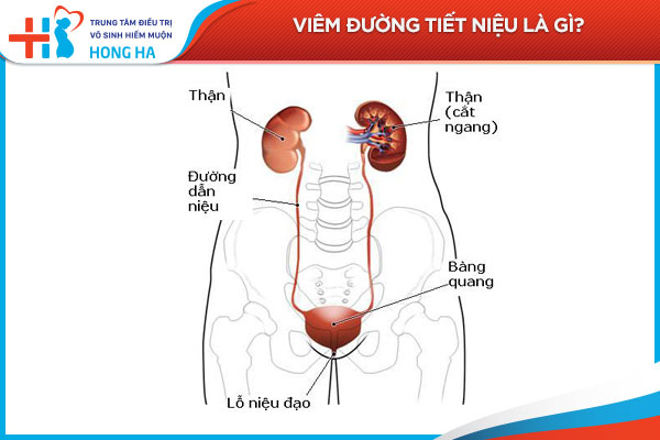 Viêm đường tiết niệu do vi khuẩn chiếm 80%: Cách phòng và điều trị