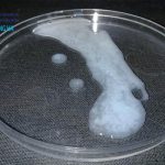 Vô sinh ở nam giới: Nguyên nhân, triệu chứng và phương pháp khắc phục