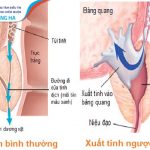Xuất tinh ngược: Nguyên nhân, triệu chứng và cách điều trị hiệu quả
