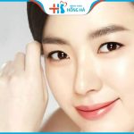 Cắt cánh mũi: 2 phương pháp thực hiện, giải đáp 9 câu hỏi liên quan