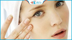 9+ Cách trị thâm quầng mắt vĩnh viễn chỉ sau 1 đêm