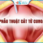Chi phí mổ cắt tử bao nhiêu? Bảng giá cắt tử cung tại Hồng Hà
