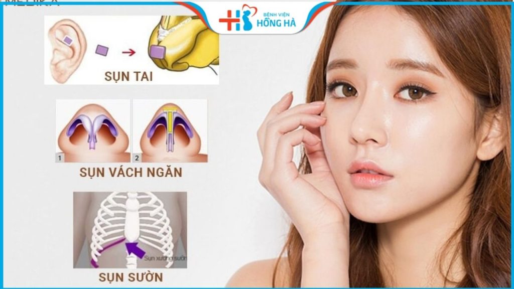Chỉnh hình mũi phức tạp là gì? Quy trình thực hiện thế nào?