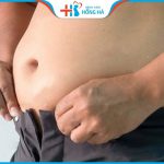 Hút mỡ bụng đàn ông: Đánh bay bụng phệ, bụng bia chỉ sau 120 phút