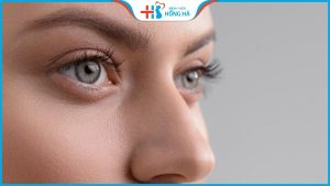 Nâng mũi cấu trúc Nanoform là gì? Mũi Cao Sang, Đẹp Tự Nhiên