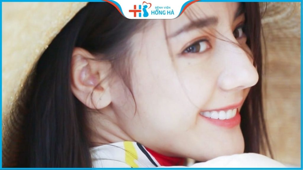 Nâng mũi sụn nhân tạo an toàn không? Cảnh báo 3 sai lầm khi nâng mũi
