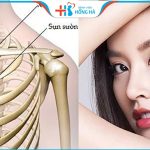 Thế nào là nâng mũi sụn sườn tự thân? Giá bao nhiêu? Vĩnh viễn không?