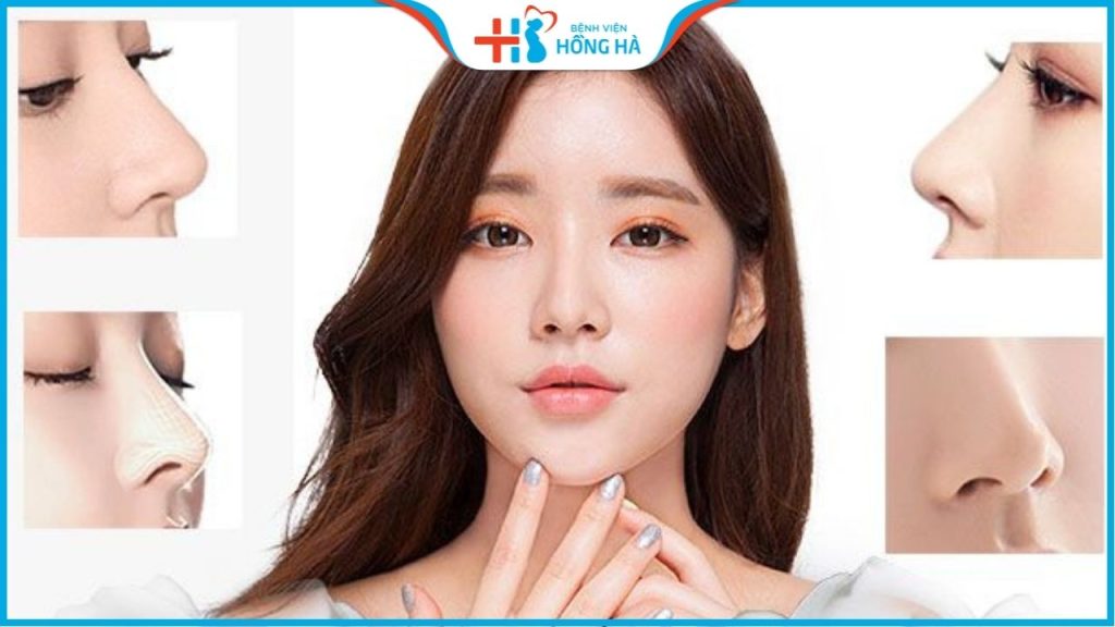 11 phương pháp phẫu thuật nâng mũi hiện đại giúp lột xác hoàn hảo