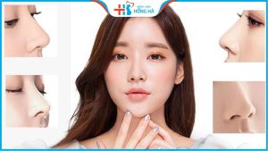 11 phương pháp phẫu thuật nâng mũi hiện đại giúp lột xác hoàn hảo