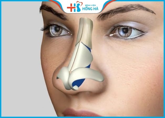 Thu nhỏ đầu mũi có đau không là thắc mắc của nhiều bệnh nhân