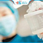 Xét nghiệm tinh dịch đồ ở đâu chính xác – Review địa chỉ tốt nhất 