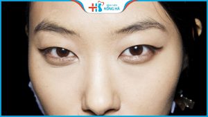 Mắt xếch là gì – 2 phương pháp cải thiện mắt xếch hiệu quả