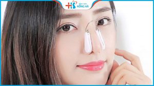 Kẹp nâng mũi có nâng được dáng mũi không?