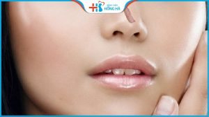 Bị sẹo lồi sau khi nâng mũi phải làm sao? Nguyên nhân gây sẹo do đâu?