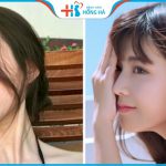 Các dáng mũi nâng đẹp được ưa chuộng nhất hiện nay