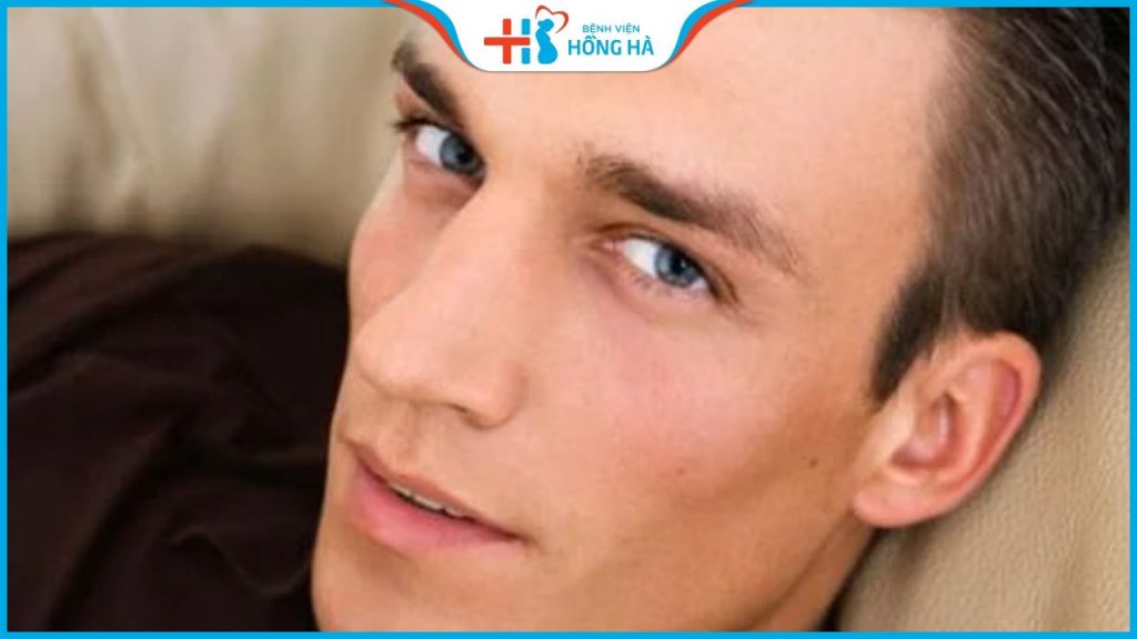 Nâng mũi gồ là gì? Giá bao nhiêu? Có bị tái lại sau phẫu thuật không?