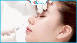 Nâng mũi rồi có tiêm filler được không? Bác sĩ Robert Nguyễn trả lời