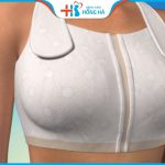 Nâng ngực chảy xệ tại Hồng Hà lột xác vòng 1 đầy đặn cho phái đẹp